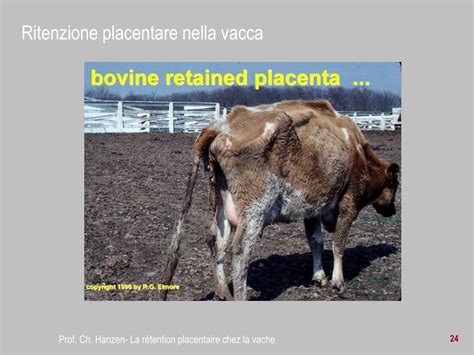 Illustrazione delle diverse forme di ritenzione placentare