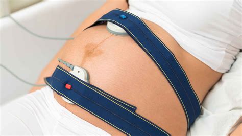 Cardiotocografia esterna durante il monitoraggio fetale