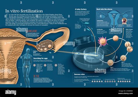 infografica che illustra i tassi di successo della fecondazione in vitro tra diversi gruppi etnici