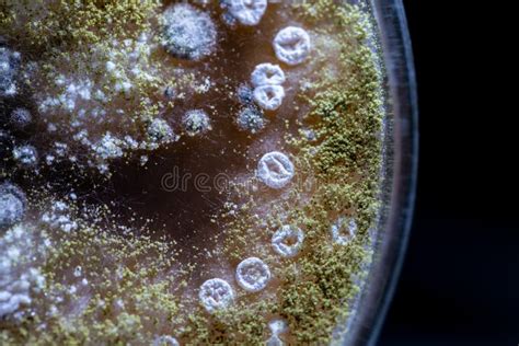 Microscopio che mostra batteri del suolo responsabili del petricore