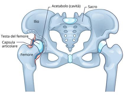 rappresentazione anatomica dell'articolazione dell'anca e della protesi
