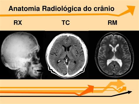 immagini diagnostiche a confronto (RMN, TAC, RX)