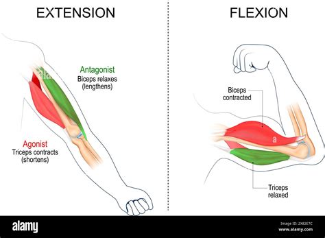 illustrazione delle fasi del riflesso di Moro: estensione e successiva flessione degli arti