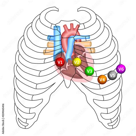 Diagramma del posizionamento degli elettrodi precordiali V1-V6