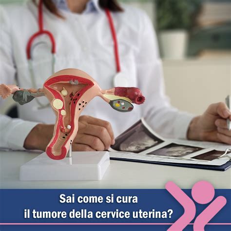 Diagramma della vagina e della cervice uterina