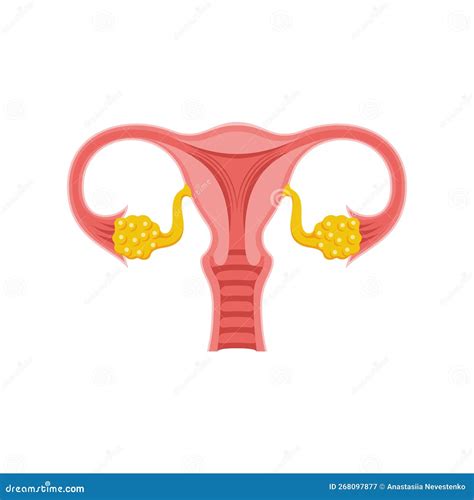 rappresentazione schematica dell'endometriosi nel sistema riproduttivo femminile