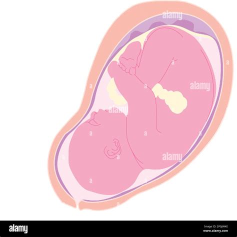 Illustrazione di un feto in utero con indicata la misurazione della translucenza nucale