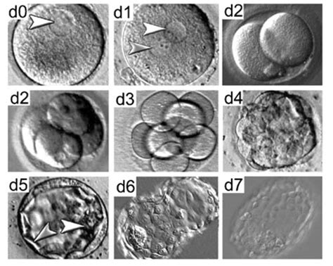 Microscopia di una blastocisti di buona qualità
