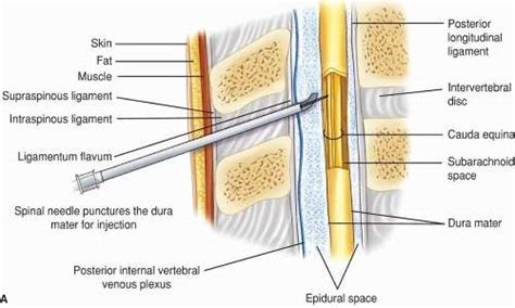 Anatomia della colonna vertebrale e dello spazio epidurale