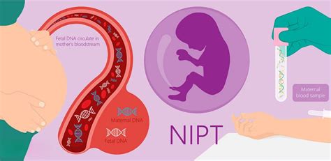 Infografica sull'accuratezza dei test NIPT
