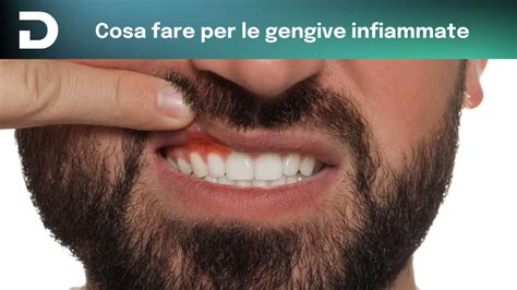 illustrazione di gengive infiammate e sane