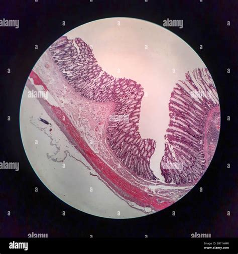 Microscopio che osserva cellule spermatiche