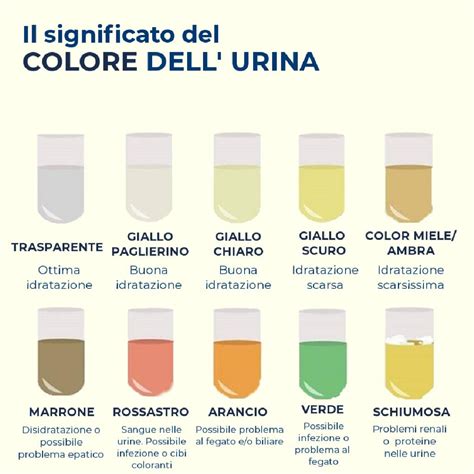 infografica sulle procedure di corretta conservazione dell'urina per il test