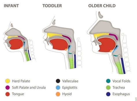 Illustration comparing tongue position during physiological and infantile swallowing, showing palate expansion difference.