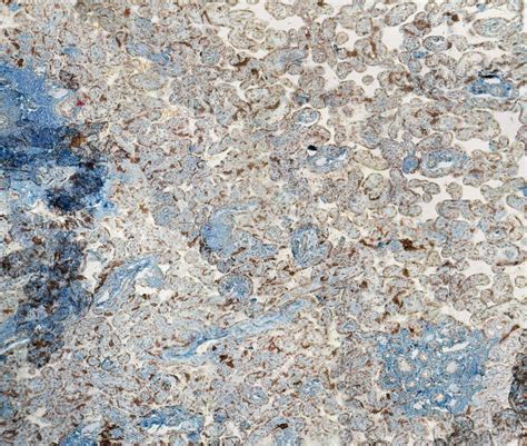 Micrografia della placenta dell'opossum