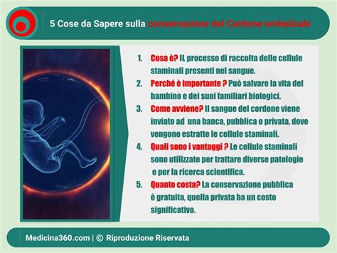 infografica che illustra il processo di donazione e conservazione del cordone ombelicale