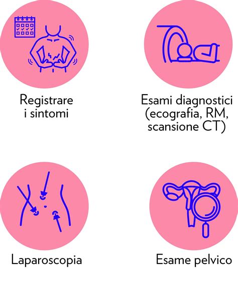 Rappresentazione anatomica delle sedi dell'endometriosi