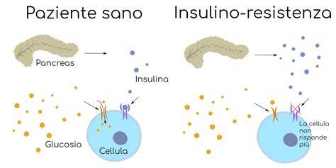 Schema che collega PCOS, ipotiroidismo e resistenza all'insulina