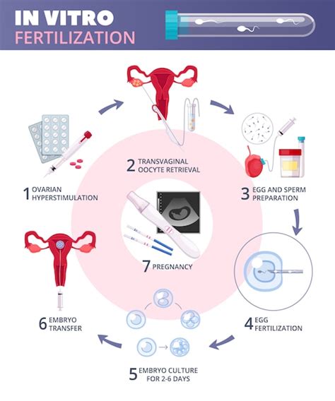 Diagramma che illustra i passaggi della Fecondazione In Vitro