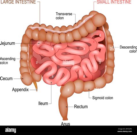 Diagramma dell'intestino infiammato del neonato