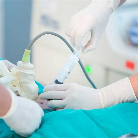 Strumenti per la diagnosi prenatale invasiva