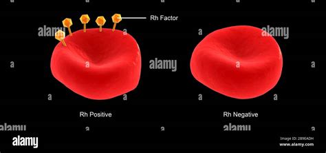 rappresentazione schematica dei globuli rossi con e senza fattore Rh