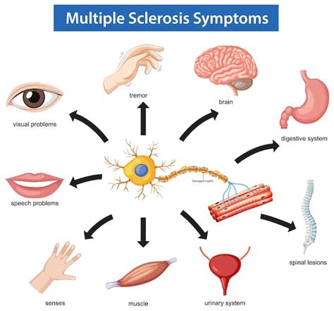Diagramma che illustra i sintomi della Sindrome Post-Abortiva
