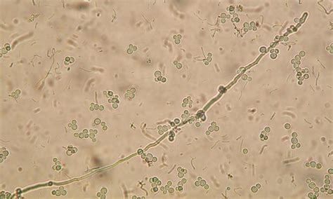 Immagine al microscopio di ife di Candida