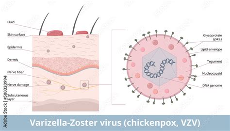 schema del virus varicella zoster e meccanismi di trasmissione