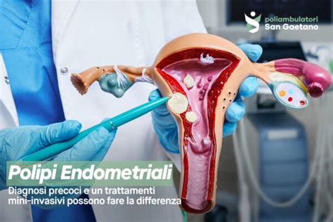 Immagine di un'isteroscopia diagnostica