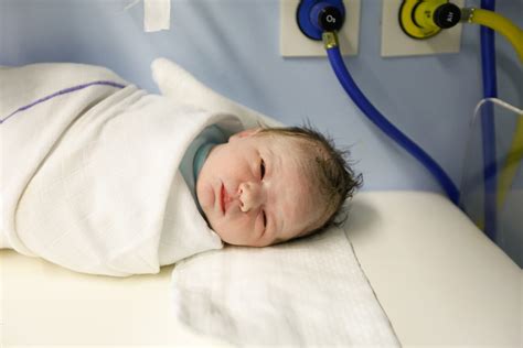 Bambino con lanugine