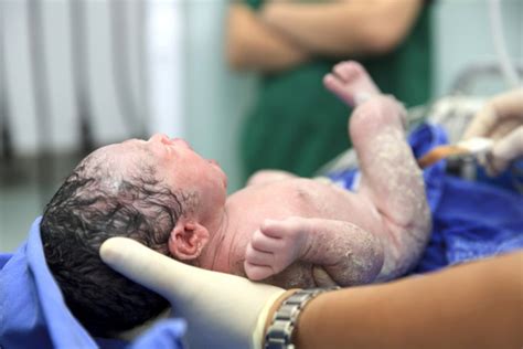 Neonato coperto di vernice caseosa
