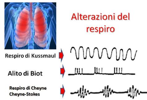 infografica che mostra le fasi del respiro periodico nel neonato