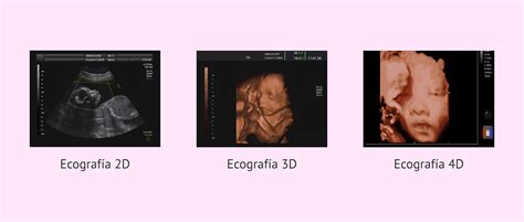Differenza tra ecografia 2D, 3D e 4D
