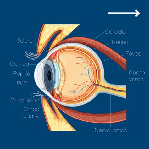 Occhio umano con rappresentazione di degenerazione retinica