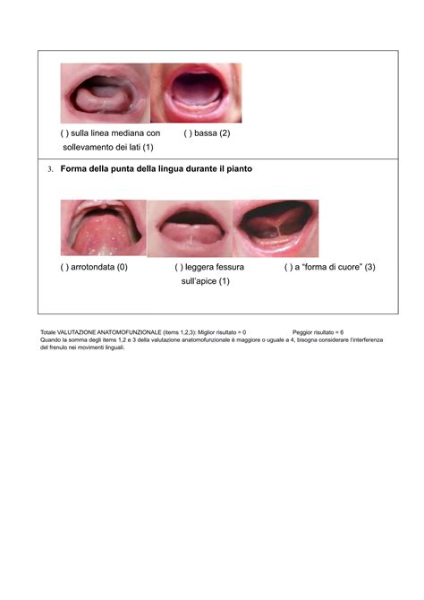 Schema che illustra le diverse valutazioni del frenulo linguale