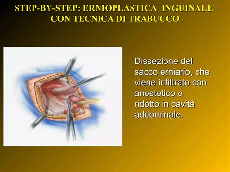 Intervento di ernioplastica