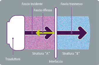 Illustrazione del meccanismo di funzionamento di un succhia clitoride manuale