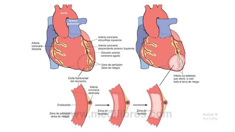 Fisiopatologia dei danni cardio-metabolici