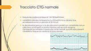 Esempio di tracciato CTG con diversi tipi di decelerazioni