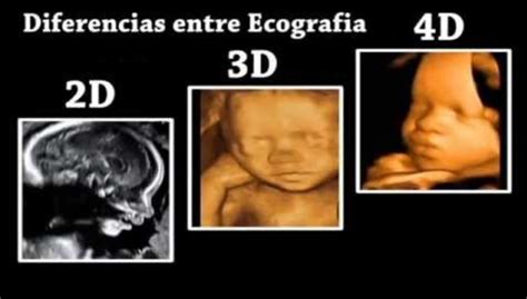 Confronto ecografia 2D, 3D e 4D