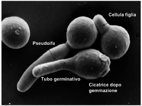 Microscopio che ingrandisce cellule di Candida albicans