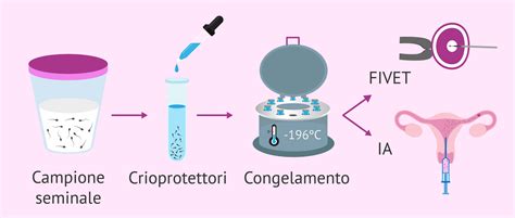 processo di crioconservazione dei gameti
