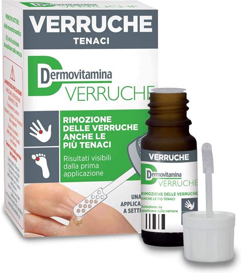 Opzioni di trattamento per le verruche