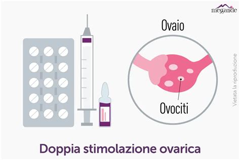 Infografica sulla doppia stimolazione ovarica (DuoStim)