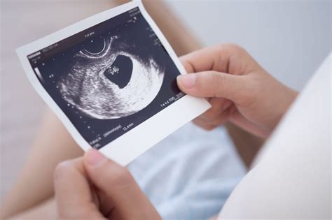 Processo diagnostico per l'aborto ricorrente