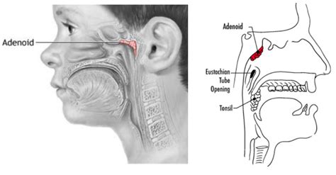 Illustrazione anatomica delle adenoidi e tonsille