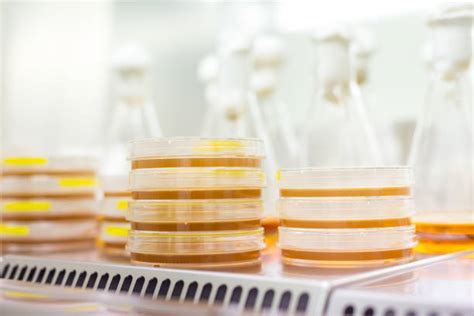 Sporata di Oudemansiella longipes su gel di Agar