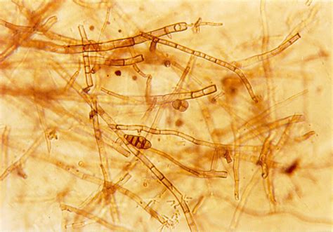 Dettaglio delle ife del micelio al microscopio