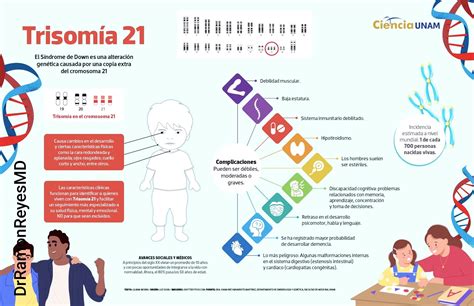 Sindrome di Down (trisomia 21) e triploidia a confronto